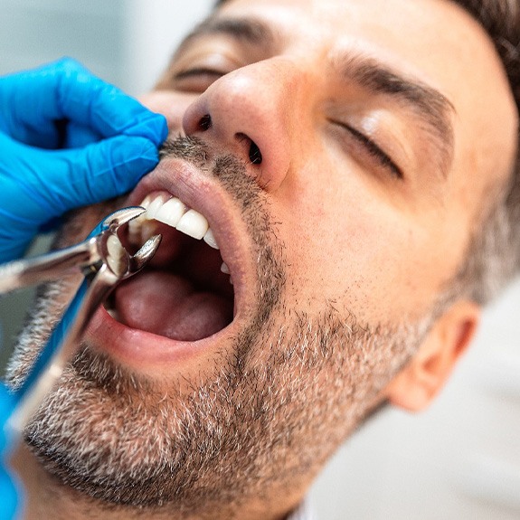 A man getting a tooth extraction