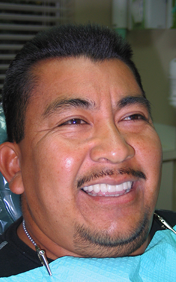 Man sharing smile after dental crown restoration