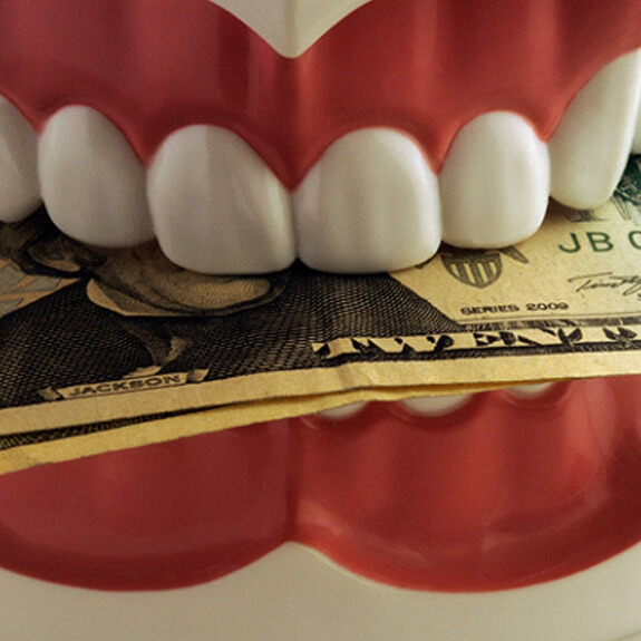 a model of a mouth with money between the teeth