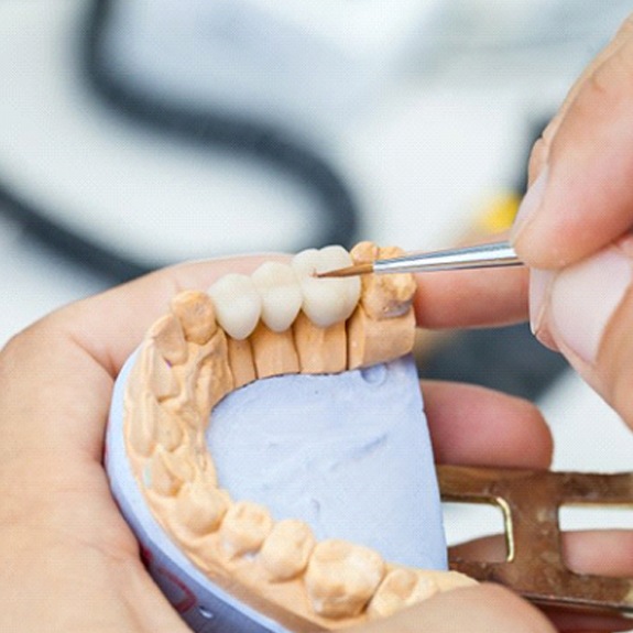 dentist in Weatherford designing a dental bridge