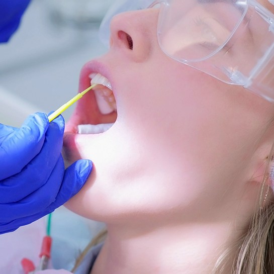 A dentist applying fluoride to a patient’s teeth