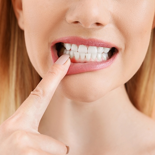Blonde woman with gum disease in Weatherford, TX, pointing to inflamed gums
