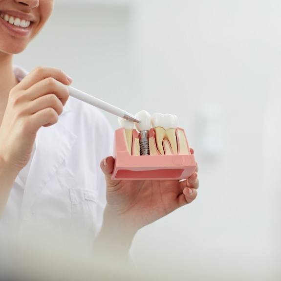 Dental team member pointing to dental implant tooth replacement model