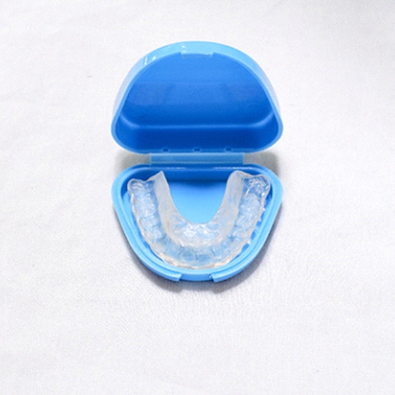 Occlusal splint for TMJ/TMD therapy in Weatherford, TX