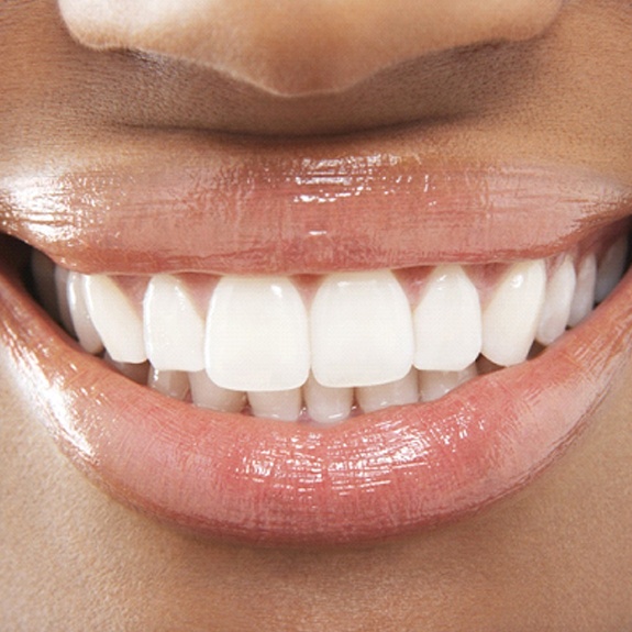 Close-up of woman’s beautiful smile with dental veneers