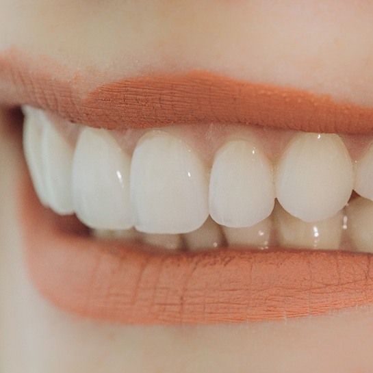 Closeup of woman smiling with veneers in Weatherford