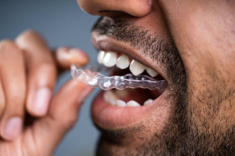 A man dealing with new aligner discomfort